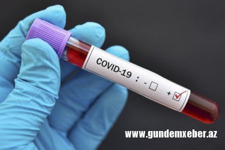 Ermənistanda son sutkada 339 nəfər COVID-19-a yoluxub, 8 nəfər ölüb